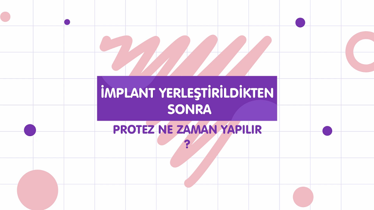 mplantlar Yerletirildikten Sonra Protezler Ne Zaman Yaplr. ?